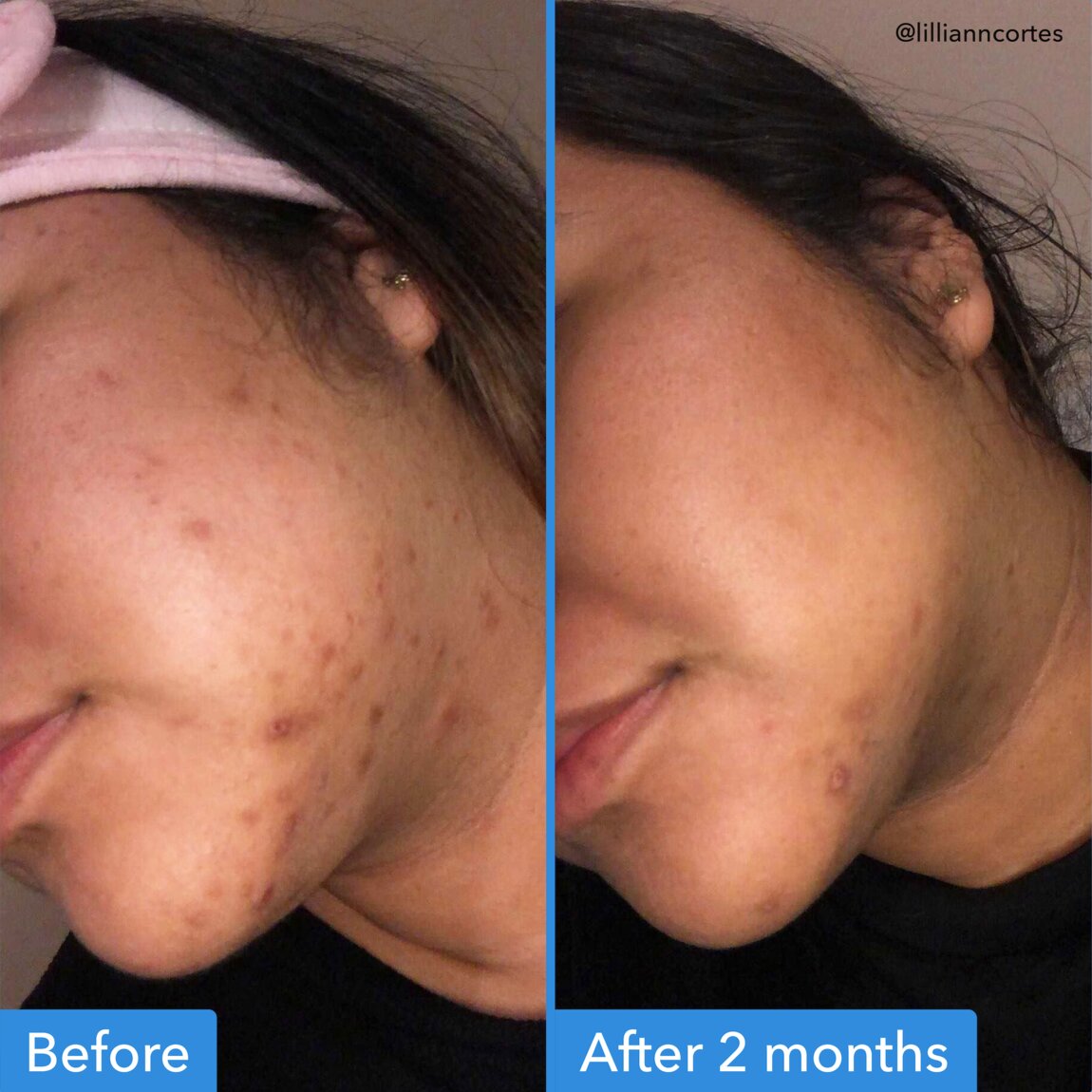 discoloration-correcting-serum-a6 zb_p.jpg