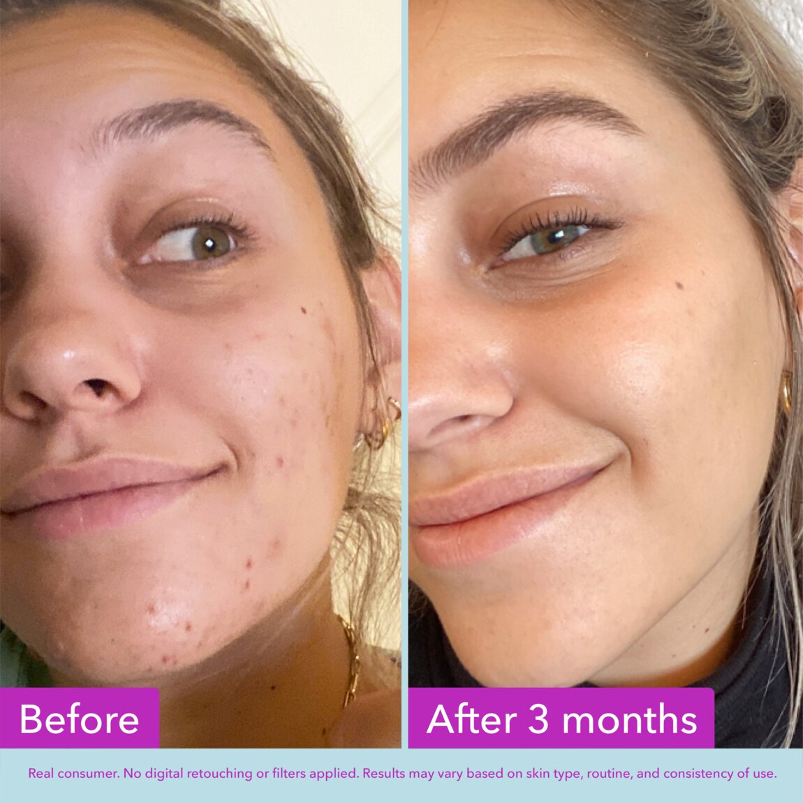niacinamide-brightening-toner-m3 zb_p.jpg