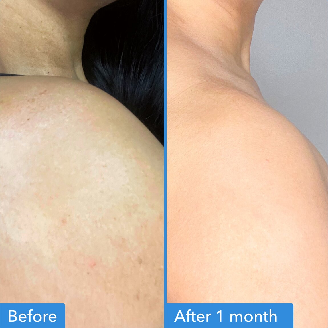 discoloration-correcting-body-treatment-y8 zb_p.jpg